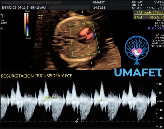 Alejandro Gaspar Vera-4
