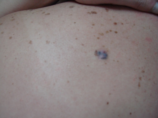 Orieta Herbas Rocha-4