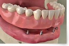 Leonel Palma Carlos-28