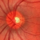 Dra. Bertha Olivia Martínez