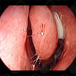 Rosalba Elizabeth Copado Ceballos-13