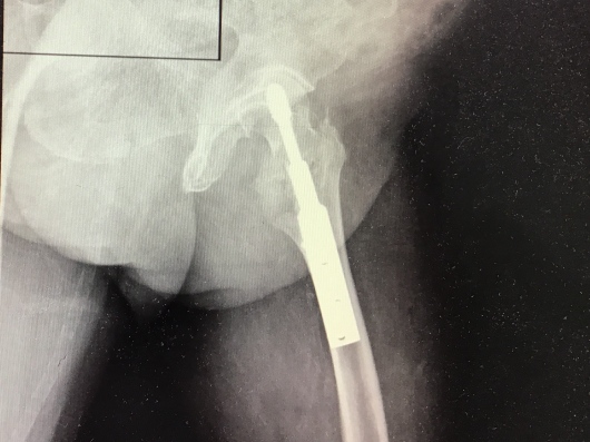 Josué Jonatan Arcia Guzmán-0