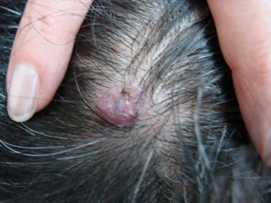 Orieta Herbas Rocha-0