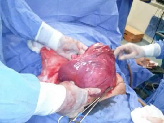 Marco Aurelio Corona Hernandez-46