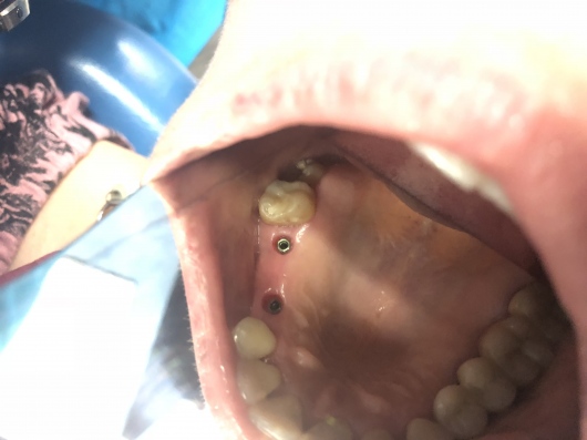 Arturo Romero Grande-39