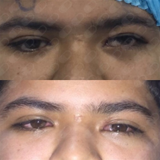 Ana Marcky Parra Robles-4