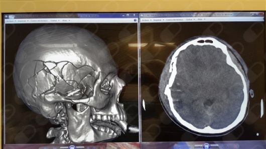 Adrian Aguilera Lorenzini-5