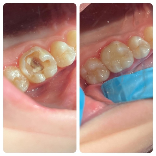 Arturo Romero Grande-26