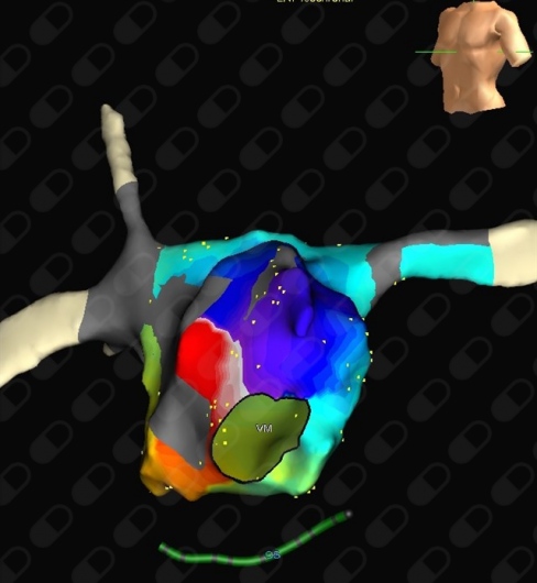 Alex Daniel Pacheco Bouthillier-7