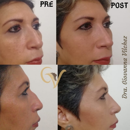 Giovanna Vilchez García-8