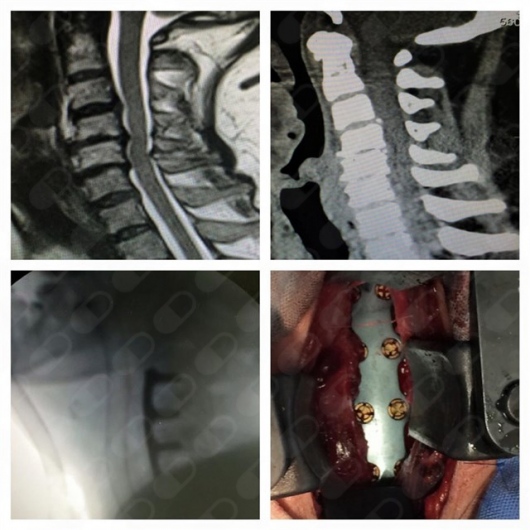 Alejandro Carlos Audiffred Mayoral-3