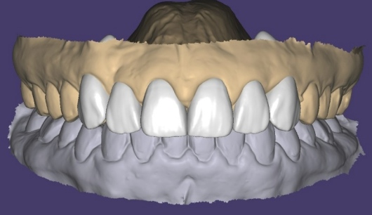 Dilan González Castrejon-7
