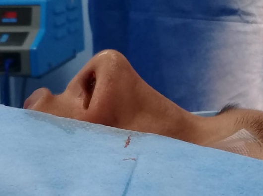 Eduardo Ivan Acuña Ramirez-6