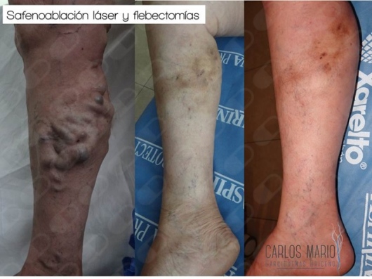 Carlos Mario Garcidueñas Briceño-12