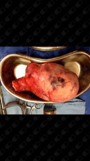 Carlos Erik Shuck Bello-12