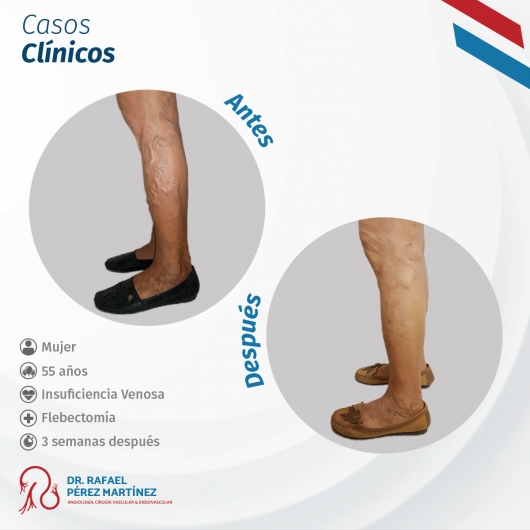 Rafael Pérez Martínez-7