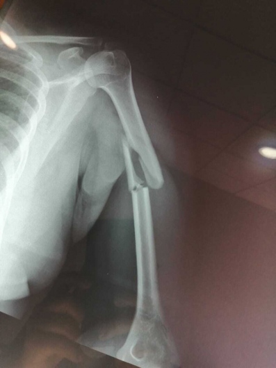 Valerio Licerio De La Cruz-12