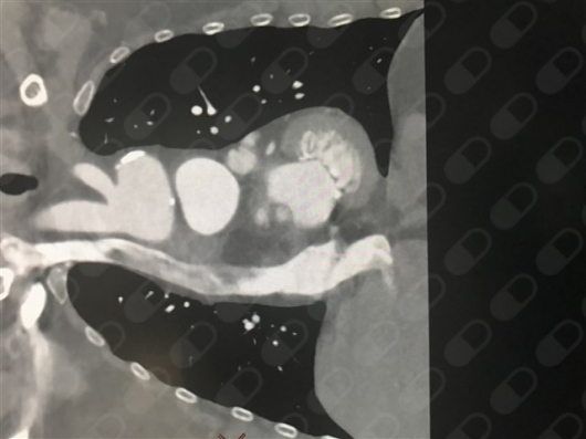 Omar Alejandro Márquez Valero-0