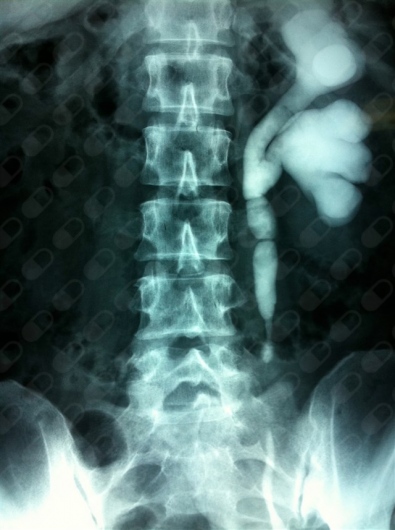 Carlos Erik Shuck Bello-14