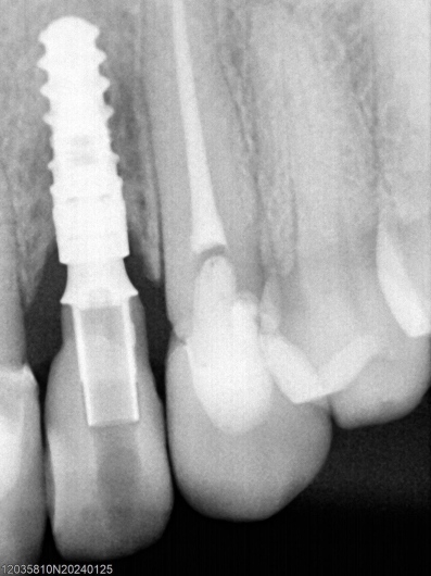 Glenn Aguayo Reyes-1