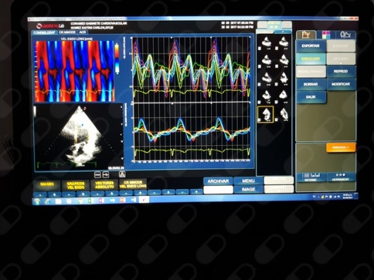 Carlos Eduardo Gómez Gaitán-6