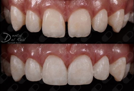 José Francisco Del Real García-93