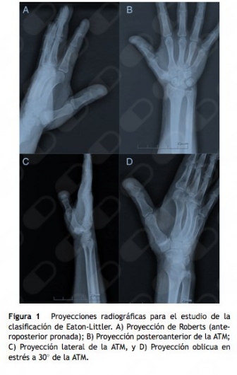 Oscar Fernando Orozco Romo-14
