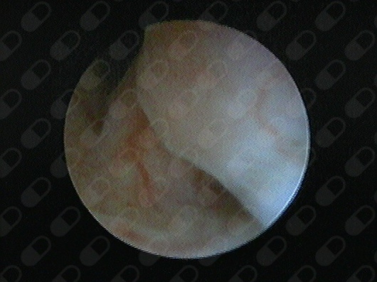 Alfonso Valdés Domínguez-15