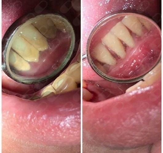 Analí García García-10