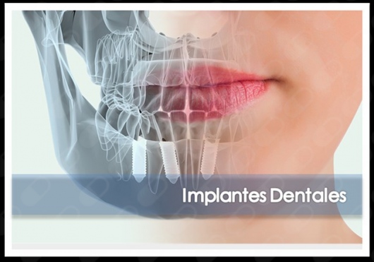 Laura Karina Uribe Fentanes-15