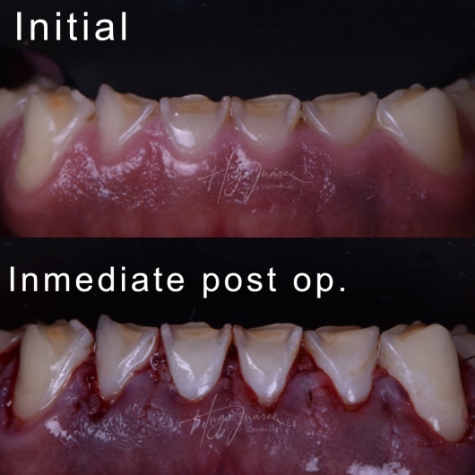 Hugo Juárez César-2