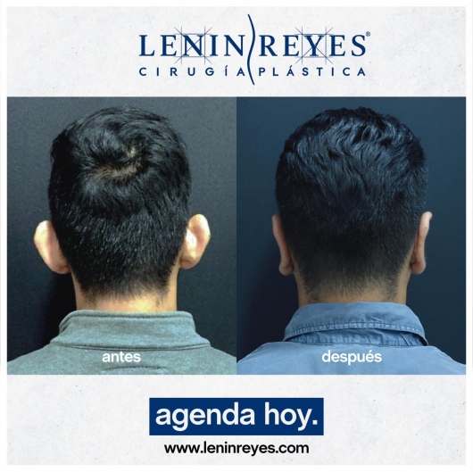 Lenin Alfonso Reyes Ibarra-45