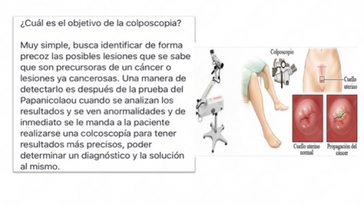 Marbella Flores Castañeda-7