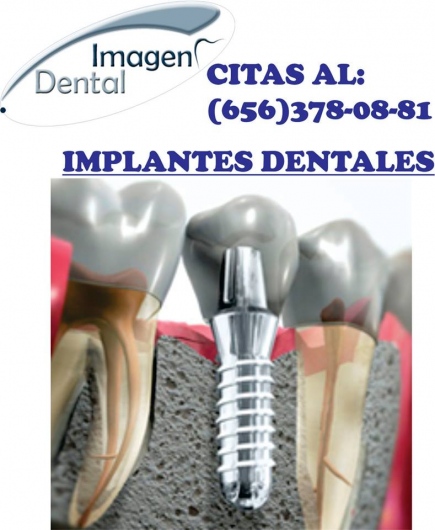 Leonel Palma Carlos-21