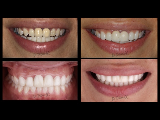 Dilan González Castrejon-25