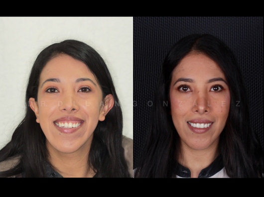 Dilan González Castrejon-24