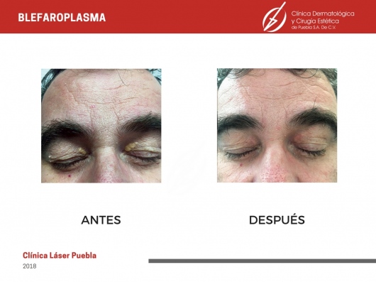 Dafne Arellano Montalvo-34