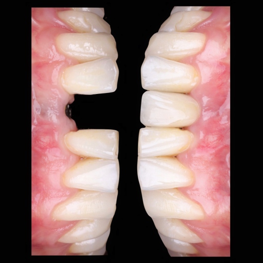 Dilan González Castrejon-14