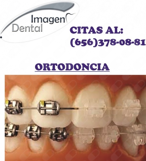 Leonel Palma Carlos-0