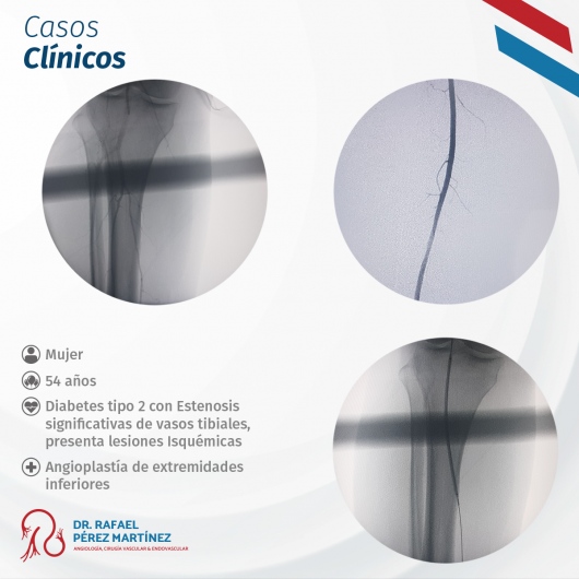 Rafael Pérez Martínez-11