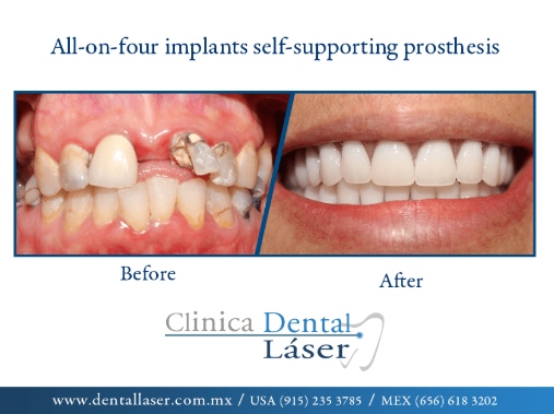 Zonia Edith Barrandey Orozco-4