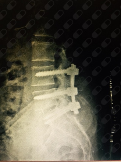 Carlos Josué Victoria Buitimea-6