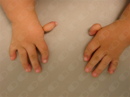 Miguel Angel Hernández Alvarez-7