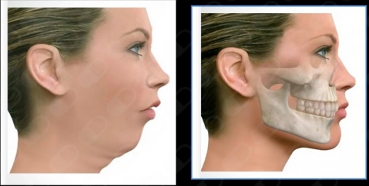 José Antonio García Piña-8