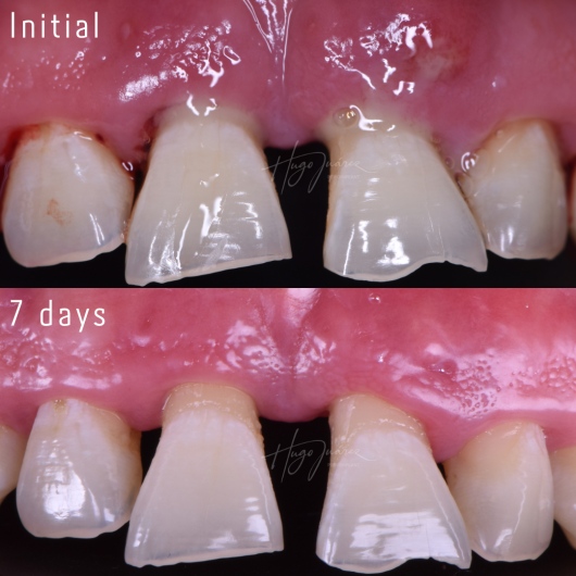 Hugo Juárez César-1