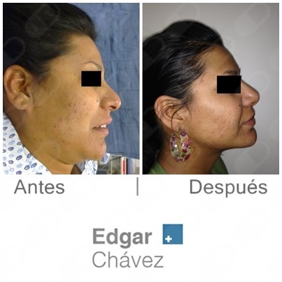 Edgar Chávez Oseguera-0