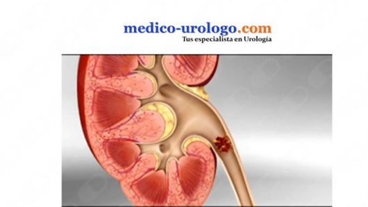 Jesus Bernal Hernández-12