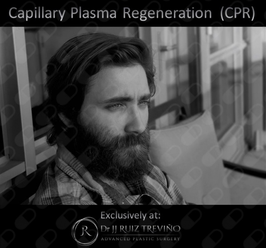 Juan José Ruiz Treviño-14