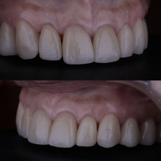 Hugo Moran Negrete-12