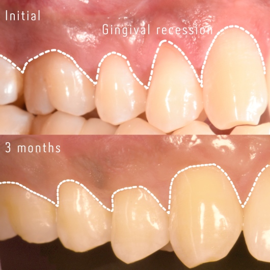 Hugo Juárez César-3